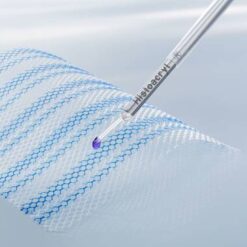 Histoacryl LapFix, Atraumatische Netzfixierung für die laparoskopische Hernienchirurgie